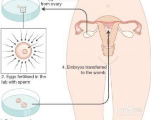 为什么胚胎染色体问题会不断出现，如何避免？