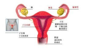 捐卵试管婴儿胚胎的类型和优点 – 新鲜胚胎、冷冻胚胎还是囊胚哪个更好？