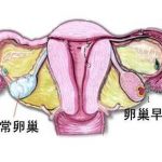 郑州借卵试管医院:哪些人需要染色体检查? 郑州借卵试管医院:哪些人需要染色体检查?