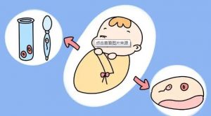 武汉生殖医学中心供卵试管流程常见问题？