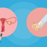 子宫内膜薄的饮食调理