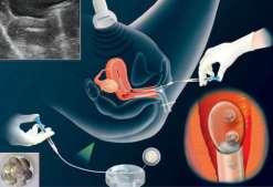 广东医院助孕排名？(2023广东省人民医院试管成功率预估)
