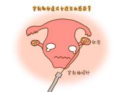 “胚胎培育”输卵管有问题可以做试管婴儿吗