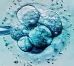 广东三代试管选性别权威医院排名