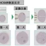 广西第三代试管婴儿双胞胎男孩的费用多少