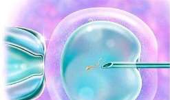 呼和浩特染色体缺失做第三代试管有成功的吗_正规助孕医院