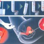 哈尔滨三代试管助孕医院