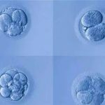 HIV患者在泰国做三代试管需要多少费用