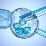 杭州三代试管拒绝羊水穿刺