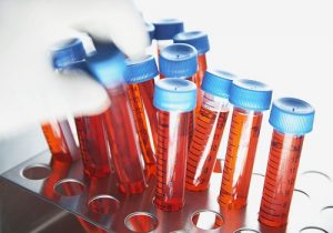 41岁基础卵泡多少正常 有3个卵泡可以做试管吗