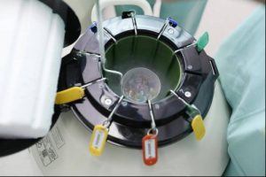 供卵试管助孕冷冻卵子对女性有伤害吗？