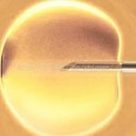 淄博三代试管婴儿借卵生子医院排名最新汇总