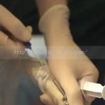 宿州三代试管还会染色体异常吗?三代试管能排除染色体遗传吗 宿州三代试管还会染色体异常吗?三代试管能排除染色体遗传吗