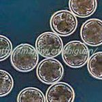 2023高龄能通过三代试管婴儿怀混血婴儿吗 2023高龄能通过三代试管婴儿怀混血婴儿吗