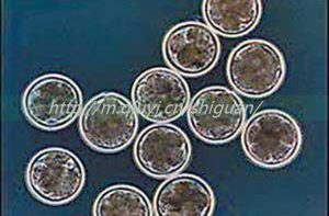 2023高龄能通过三代试管婴儿怀混血婴儿吗