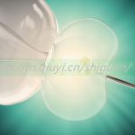 乌鲁木齐三代试管婴儿供卵生孩子医院合法吗 乌鲁木齐三代试管婴儿供卵生孩子医院合法吗