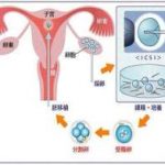 第三代试管婴儿生男孩价格是多少