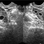 合肥三代试管助孕中心