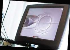 2023全国试管成功率高排名？