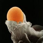 柬埔寨第三代试管可以做龙凤胎吗 柬埔寨第三代试管可以做龙凤胎吗