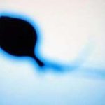 思则凯什么时候打 卵泡多大开始打思则凯 思则凯什么时候打 卵泡多大开始打思则凯