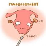 晋中三代试管群 晋中三代试管群