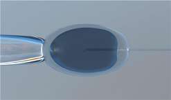 杭州三代试管选男女准吗_正规供卵试管机构