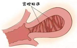 上海仁济北院做三代试管婴儿费用多少