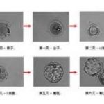 湛江三代试管选性别准确率高吗？