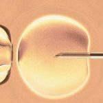 哈尔滨卵巢早衰只能做试管婴儿吗,快易便捷的服务平台