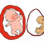 染色体缺失可以做三代试管吗:宫寒如何备孕 染色体缺失可以做三代试管吗:宫寒如何备孕
