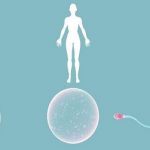 甘肃男方染色体平衡易位试管成功率