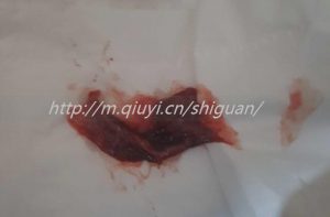 东莞三代试管供卵生孩子机构名单