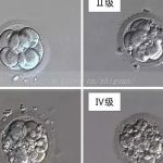 [美国三代试管]美国三代试管哪里最好
