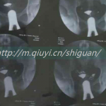 西安第三代试管_汉中第三代婴儿试管大约多少钱