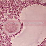 2023高龄能通过三代试管助孕捐卵生子吗