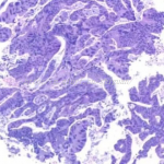 洛阳三代试管供卵生孩子公司介绍