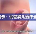 北京没有染色体异常可以做三代吗_正规辅助生殖中心 北京没有染色体异常可以做三代吗_正规辅助生殖中心