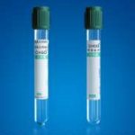 商洛三代试管dmd生正常男孩案例