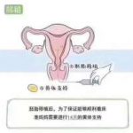 优势卵泡中的圆卵泡与扁卵泡有什么不同呢 优势卵泡中的圆卵泡与扁卵泡有什么不同呢