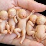 试管婴儿周期中卵泡长到多大才能取卵