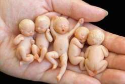 试管婴儿周期中卵泡长到多大才能取卵