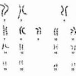 三代试管婴儿胚胎染色体筛查结果报告单要怎么看[中国试管婴儿]