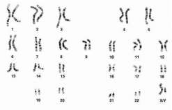 三代试管婴儿胚胎染色体筛查结果报告单要怎么看[中国试管婴儿]