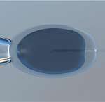 吉安三代试管最多花多少钱？