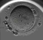 上海一妇婴三代试管怎么样 上海市第一妇婴保健院试管双胎成功率高不高 上海一妇婴三代试管怎么样 上海市第一妇婴保健院试管双胎成功率高不高