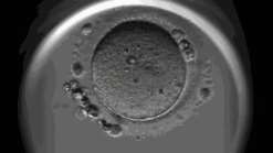 上海一妇婴三代试管怎么样 上海市第一妇婴保健院试管双胎成功率高不高