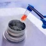 B超和阴超的区别(卵泡监测不是只能用b超检测)