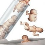 阿贝先天性卵子排出障碍可不可以做三代试管? 阿贝先天性卵子排出障碍可不可以做三代试管?