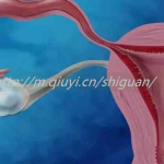 南宁三代试管助孕捐卵生孩子公司排名最新汇总